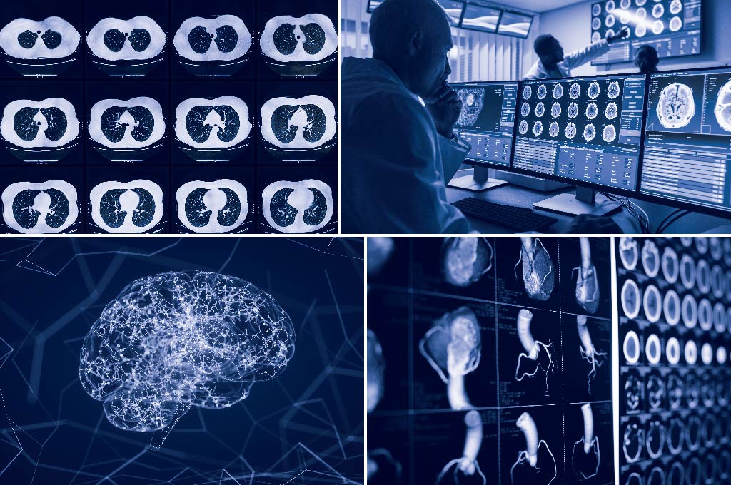 Radiology workflow processes